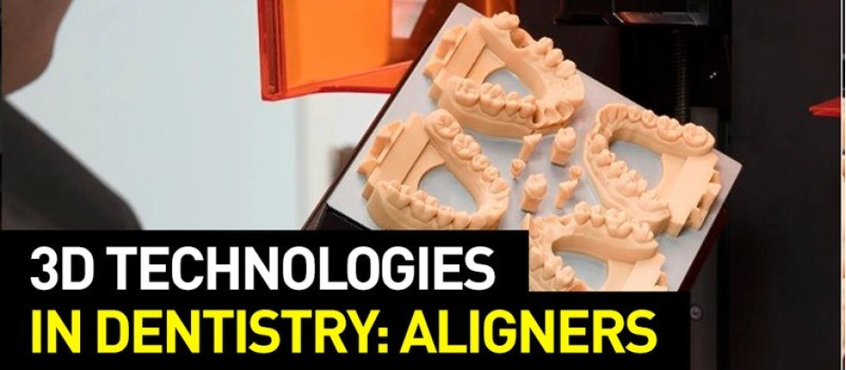 3D Technologies in Dentistry: Dental Aligners
