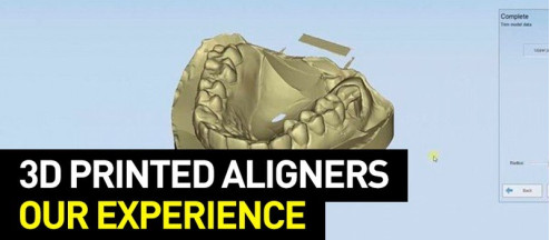 Production of Dental Aligners: Pros and Cons, Costs, Cases, and more