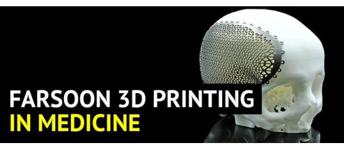 Farsoon 3D Printing in Medicine