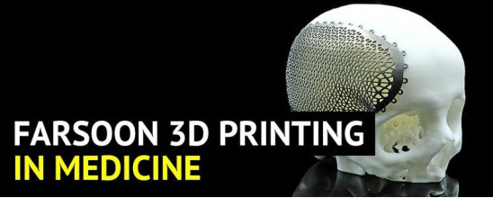 Farsoon 3D Printing in Medicine
