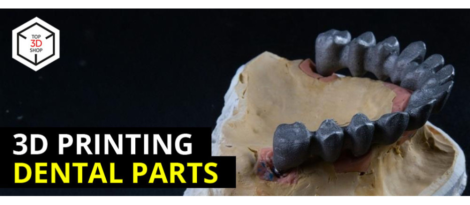 Metal 3D Printing in Dental Industry: HBD SLM 3D Printers in Dentek Lab [CASE STUDY] 