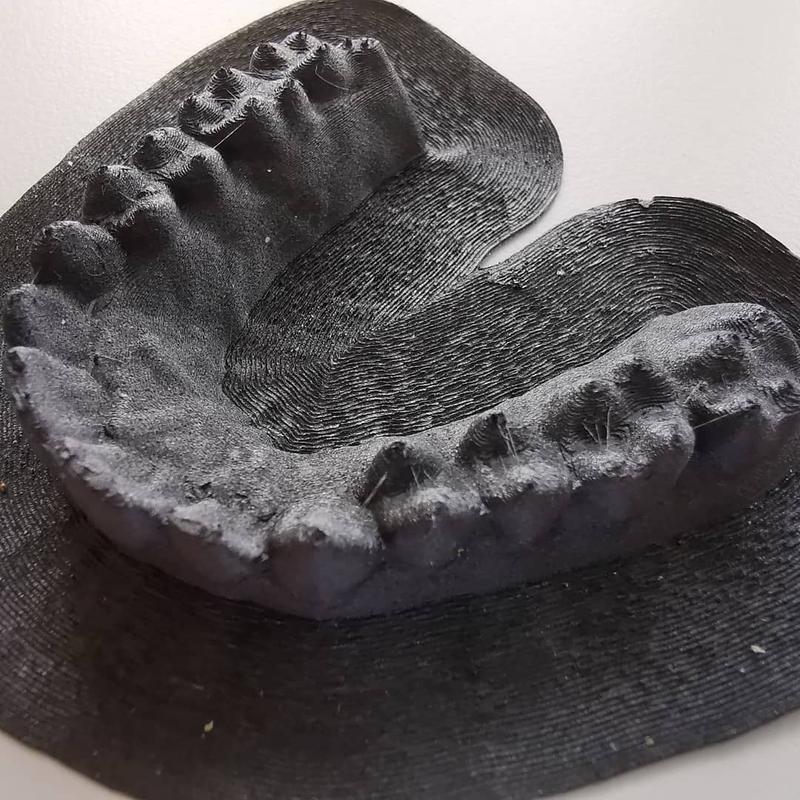 That is how a finished print looks before post-processing. As you can see, the dental impression is enough accurate and clean. It even includes minute details. 