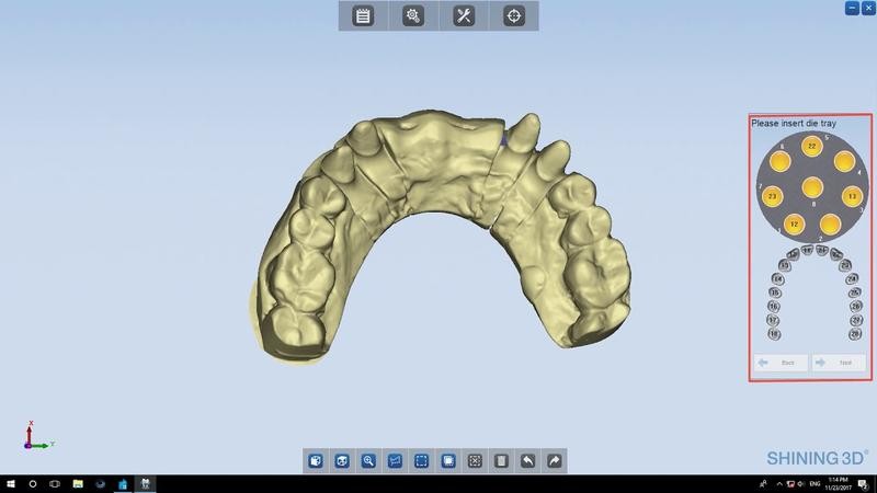 dental 3D scan