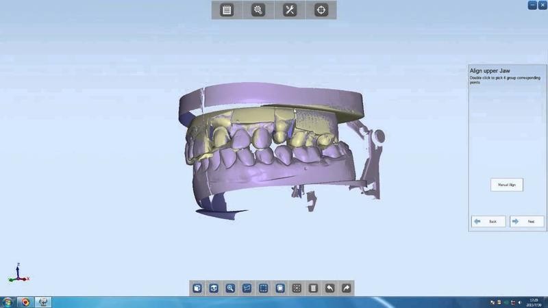 escaneado dental 3D