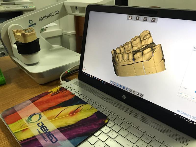 Un laboratorio dental chileno escaneó en 3D una impresión dental. Mira lo bien definida que está.