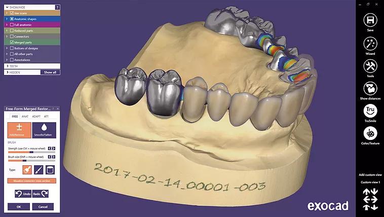 dental 3d model