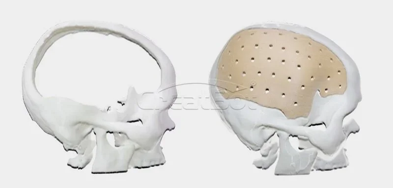 3D printed skull models with implants created by Creatbot F430, showcasing detailed craftsmanship and precision. Branding subtly visible.