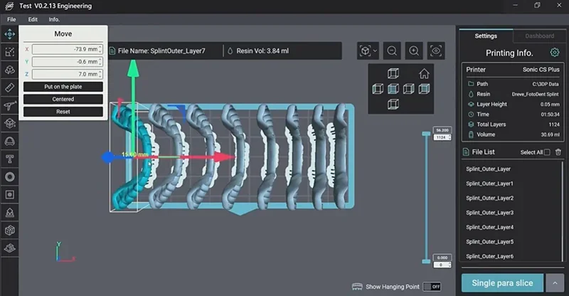3D print planning software interface showing dental splint models by Phrozen Sonic CS+, with settings panel detailing print specifications on the right.