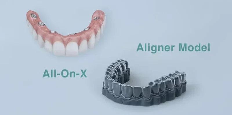 3D printed dental models 'All-On-X' and 'Aligner Model' made by Phrozen Sonic CS+ displayed on a light blue surface.