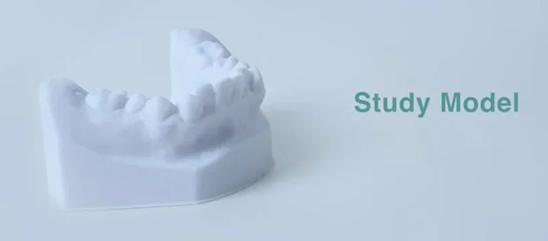 3D-printed dental study model created by Phrozen Sonic CS+ on a flat surface with text "Study Model" in the background.