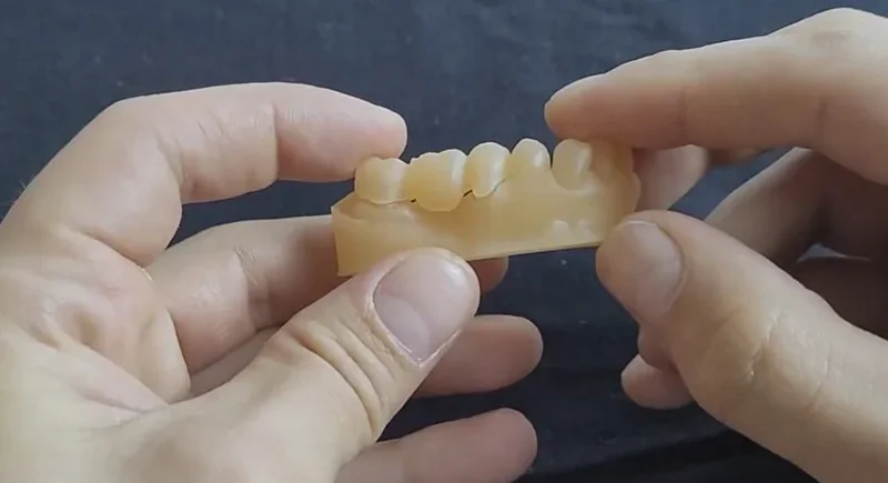 Hands holding 3D-printed dental model created by Phrozen Sonic XL 4K Plus, showcasing precision details against a dark background.