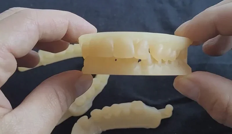 3D-printed dental model created by Phrozen Sonic XL 4K Plus, held by hands, showing detailed teeth structure on a dark background.