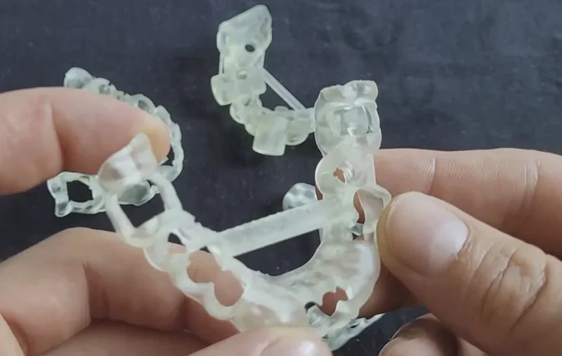 Phrozen Sonic XL 4K Plus printed dental model held in hands, showcasing clear resin detail on a dark background.