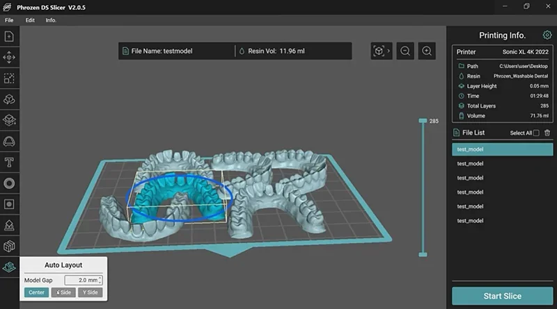 Phrozen Sonic XL 4K Plus demonstrating 3D dental models in slicer software, showing layout, model gap, and print settings on screen.
