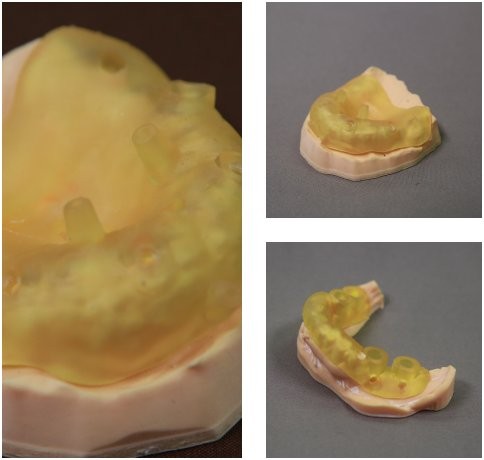 a yellow model jaw