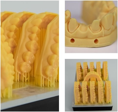 A yellow dental model